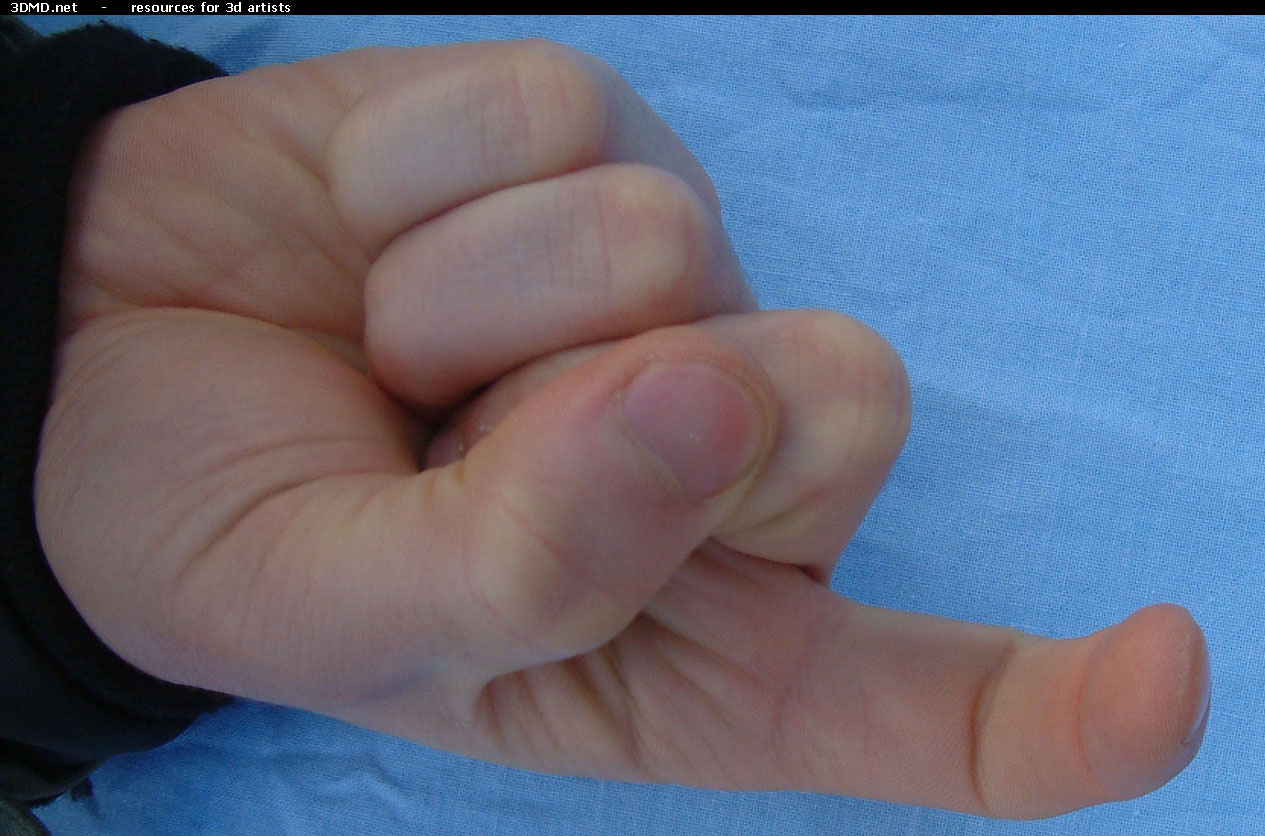 Male Forefinger Bent Bottom     