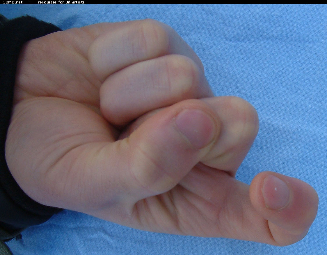 Male Forefinger Bent Bottom     