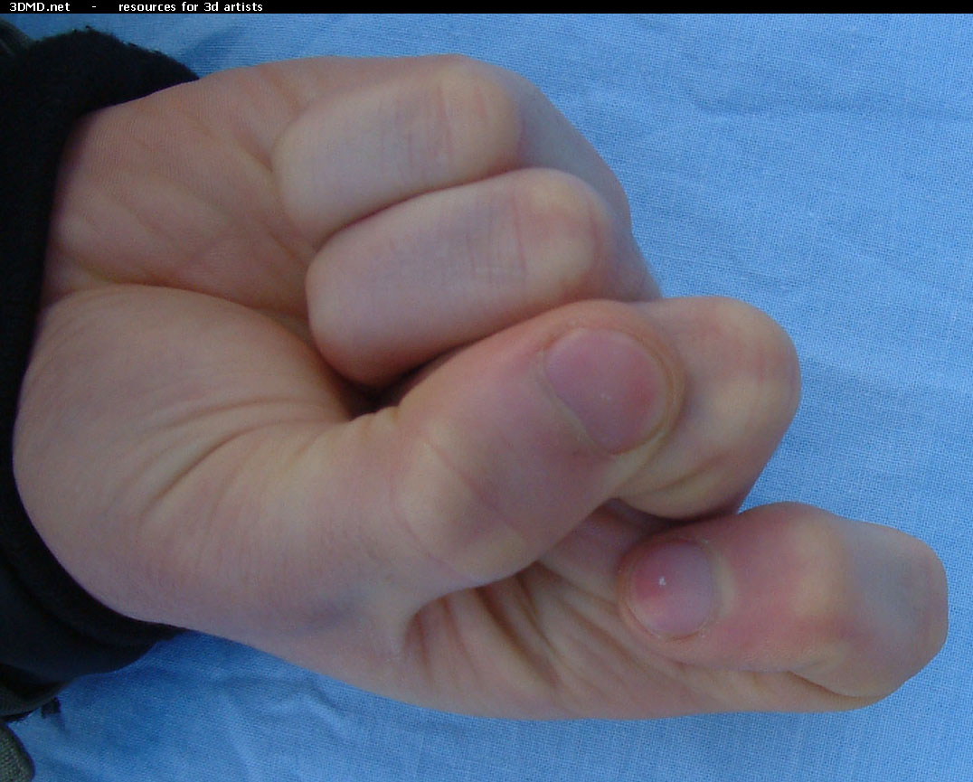 Male Forefinger Bent Bottom     