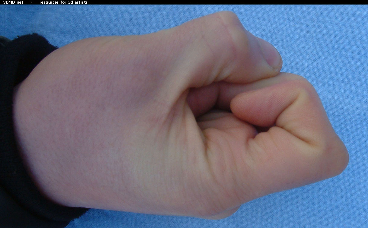 Male Forefinger Bent Left     