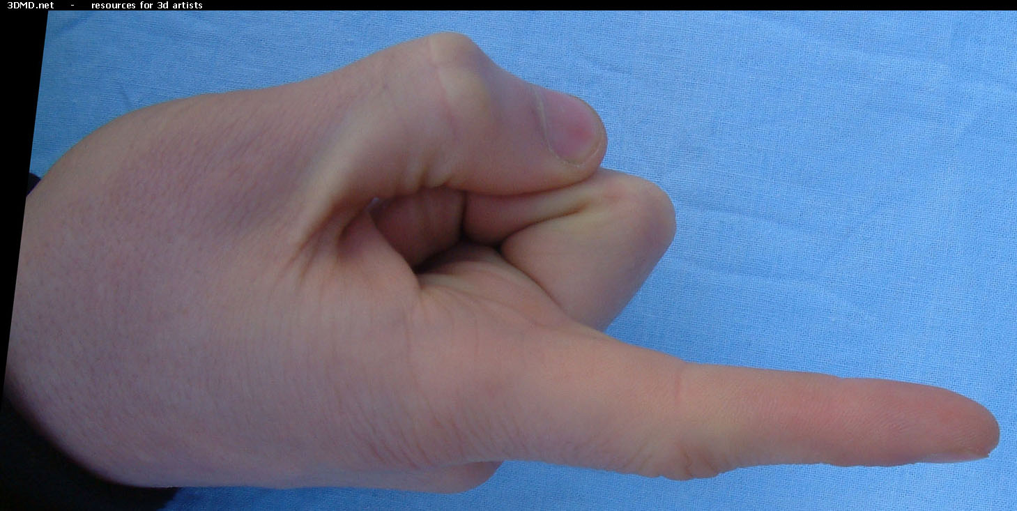 Male Forefinger Left  